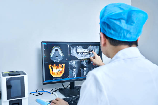 Best Emergency Tooth Extraction in White Pine, TN